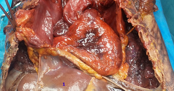 A BRIEF GUIDE TO THE ANATOMICAL DISSECTION OF THE STOMACH