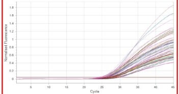 MICRORNA-21 AS NOVEL BIOMARKER FOR PANCREATIC BETA CELLS STRESS AND/OR DEATH IN PATIENTS WITH DIABETES MELLITUS TYPE 1
